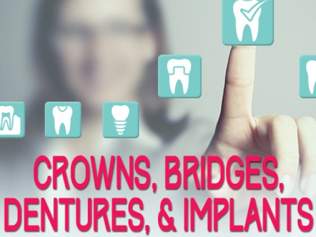 Crowns, Bridges, Dentures, and Implants: The Facts (featured image)