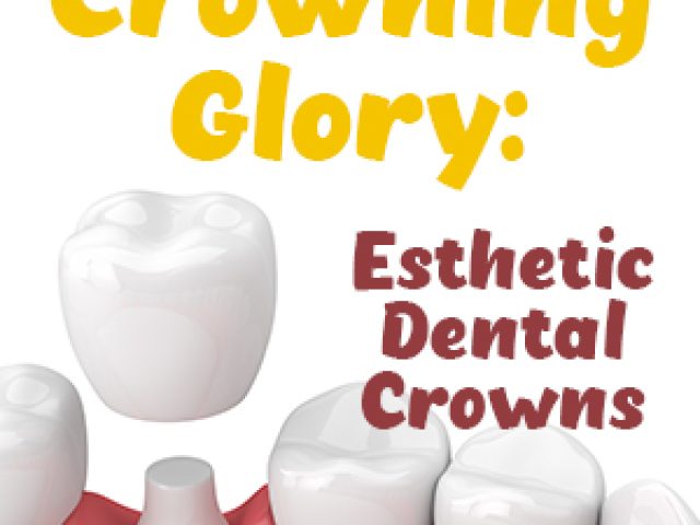 Crowning Glory: Esthetic Dental Crowns (featured image)