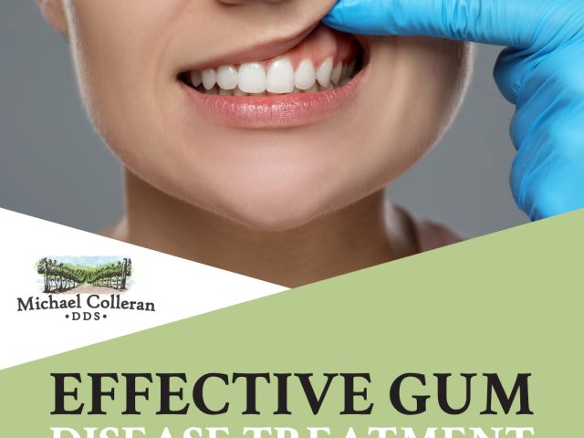 Effective Gum Disease Treatment Options in San Luis Obispo (featured image)