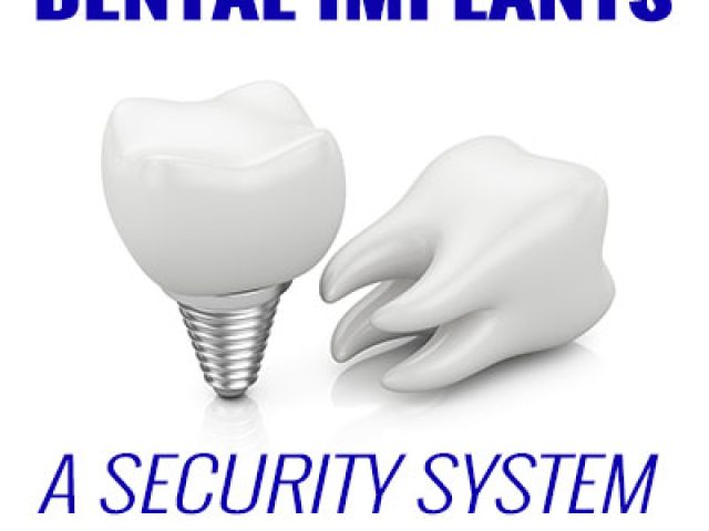 Dental Implants: A Security System for Your Smile (featured image)