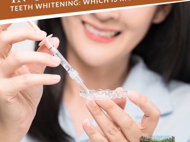 In-Office vs. At-Home Teeth Whitening: Which is Right for You? (featured image)