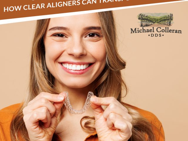 Invisalign 101: How Clear Aligners Can Transform Your Smile (featured image)