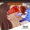 Professional Teeth Whitening Services in San Luis Obispo (featured image)