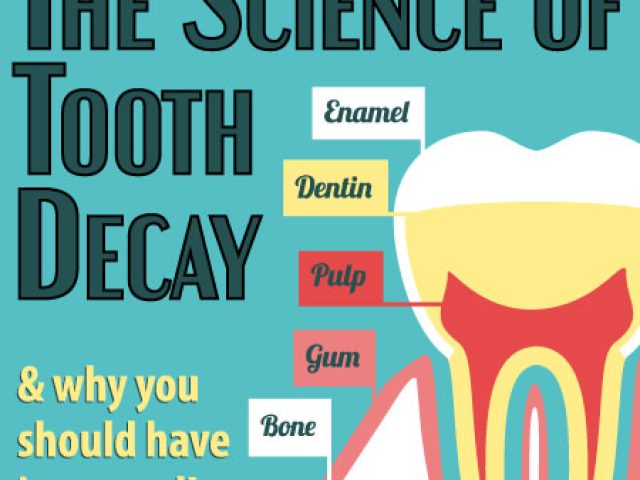 The Science of Tooth Decay (featured image)