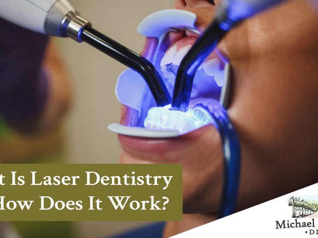 What Is Laser Dentistry and How Does It Work? (featured image)