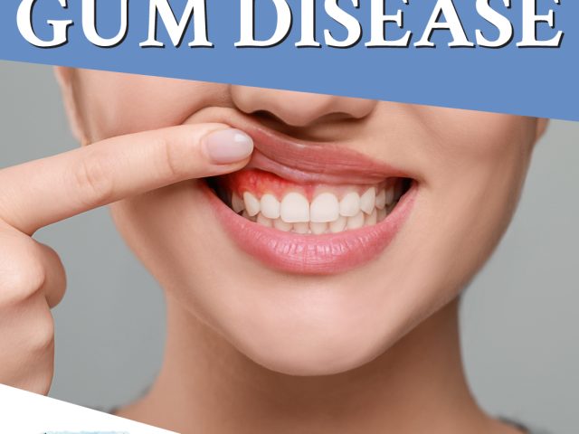 What You Need to Know About Gum Disease in San Luis Obispo (featured image)