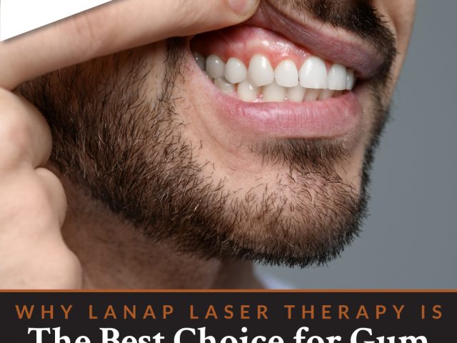 LANAP® Laser Therapy for Gum Disease in San Luis Obispo (featured image)