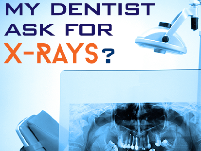 The Importance of Dental X-Rays (featured image)
